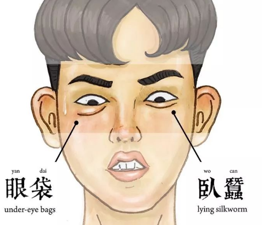 去眼袋手术
