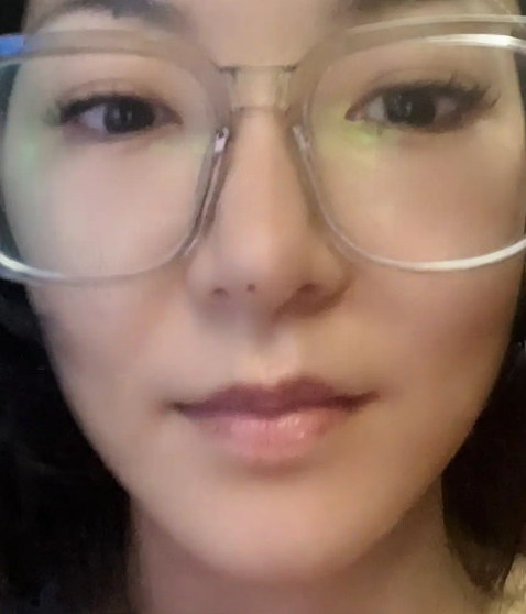 去眼袋手术