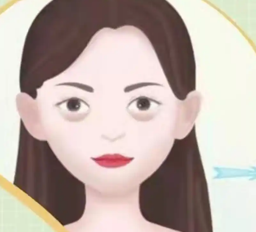 去眼袋手术