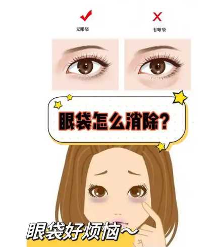 去眼袋手术