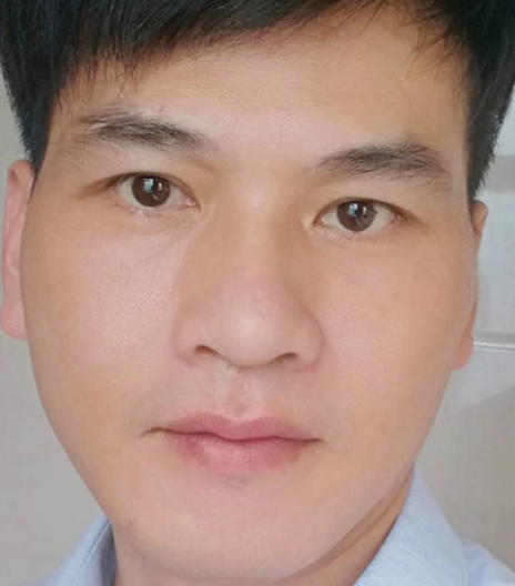 去眼袋手术