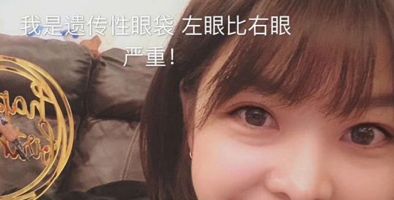 去眼袋手术
