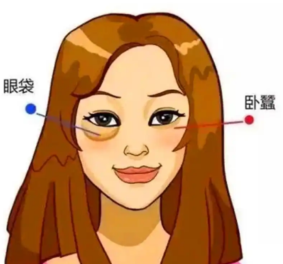 去眼袋手术