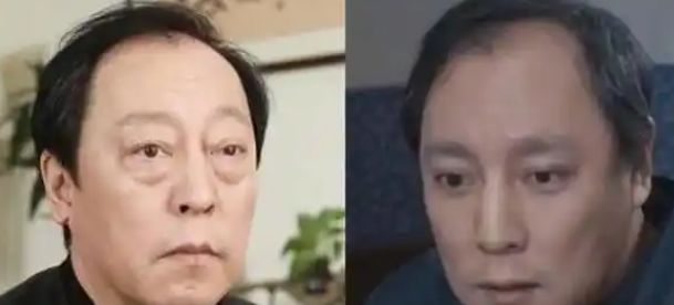去眼袋手术
