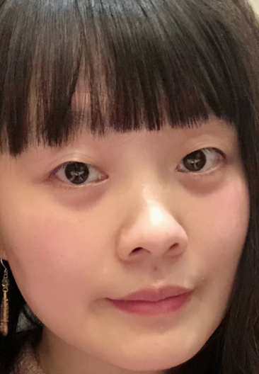 去眼袋手术