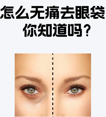 去眼袋手术