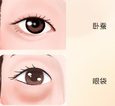 去眼袋手术