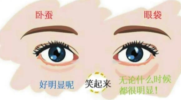 去眼袋手术