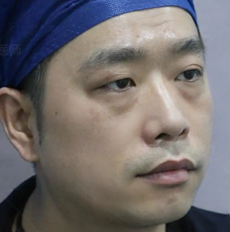 去眼袋手术