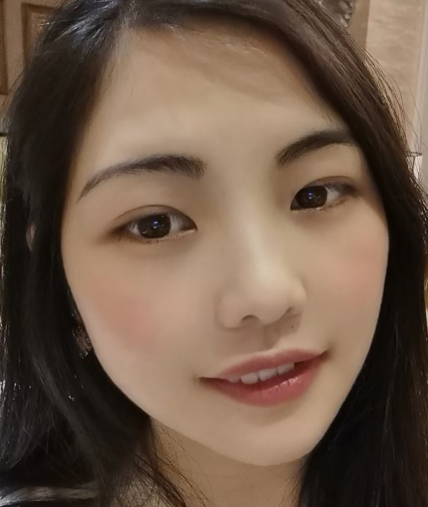 去眼袋手术