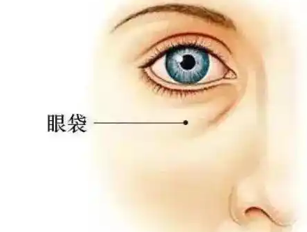 去眼袋手术