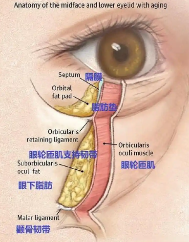 眼袋