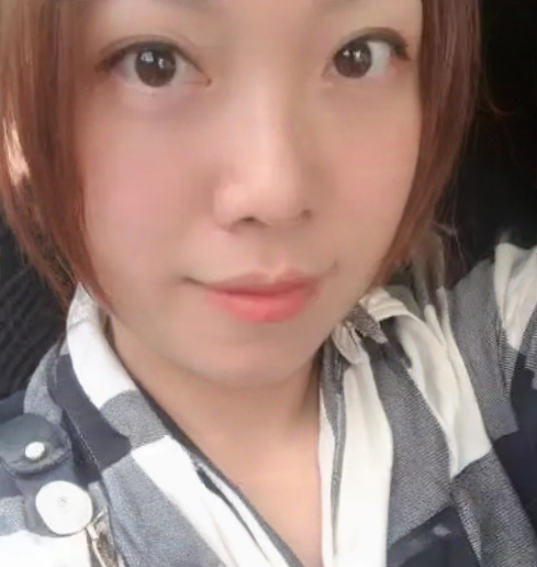 去眼袋手术