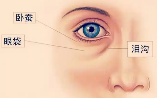 眼袋