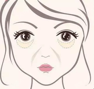 眼袋