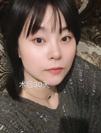去眼袋手术