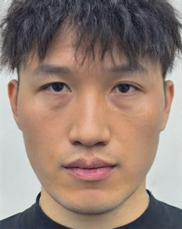 去眼袋手术