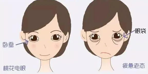 眼袋