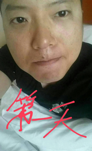 去眼袋手术