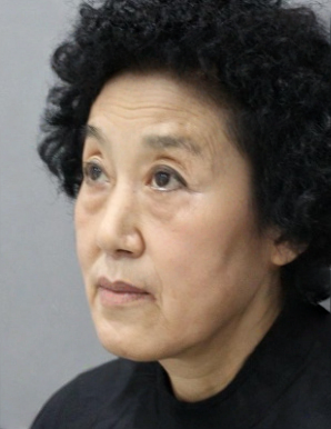 去眼袋手术