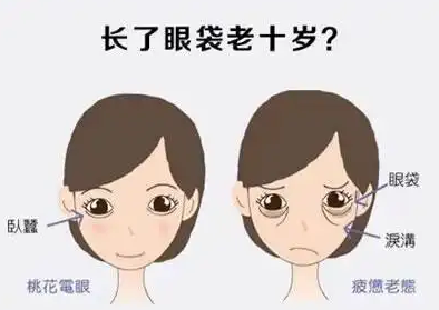 去眼袋手术