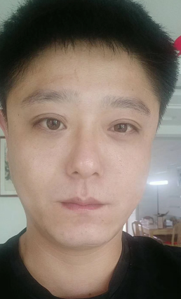 眼袋