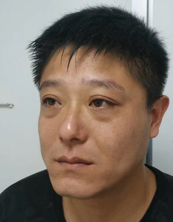 眼袋