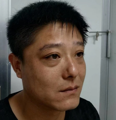 眼袋