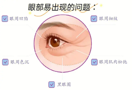 去眼袋手术