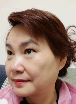 去眼袋手术