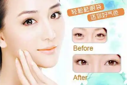 去眼袋手术
