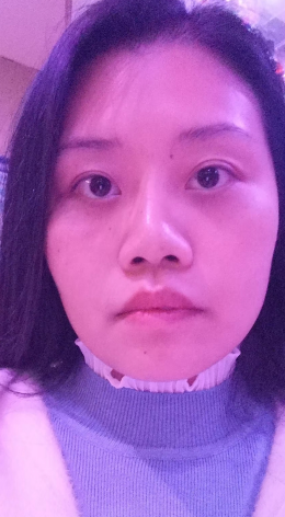 去眼袋手术