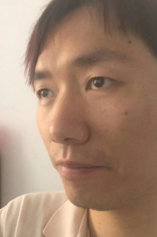 去眼袋手术