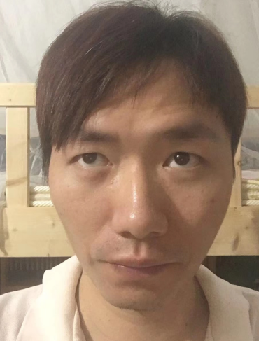 去眼袋手术