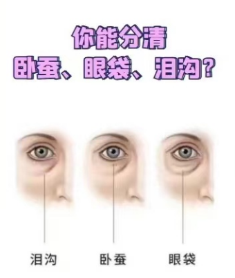 去眼袋手术