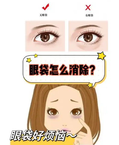 去眼袋手术