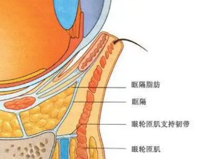 去眼袋手术