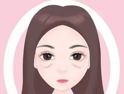 去眼袋手术