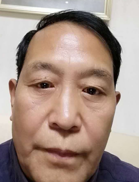 去眼袋手术