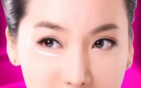 去眼袋手术