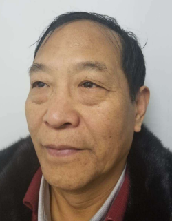 去眼袋手术