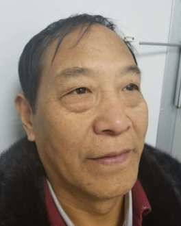 去眼袋手术