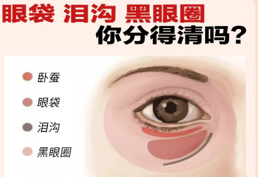 去眼袋手术