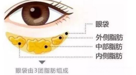 眼袋