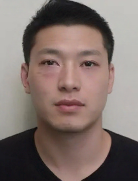 去眼袋手术