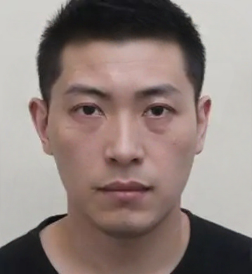 去眼袋手术