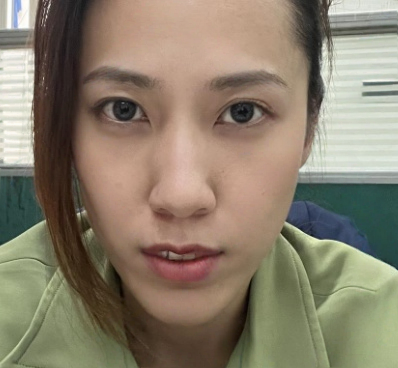 去眼袋手术