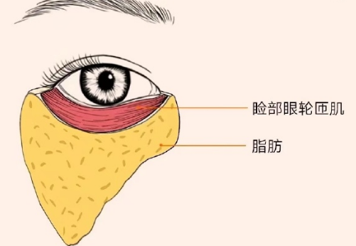 去眼袋手术