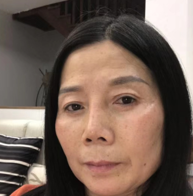 去眼袋手术