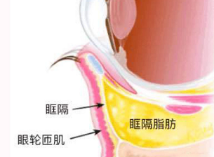 去眼袋手术